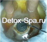 Ion Detox Bio