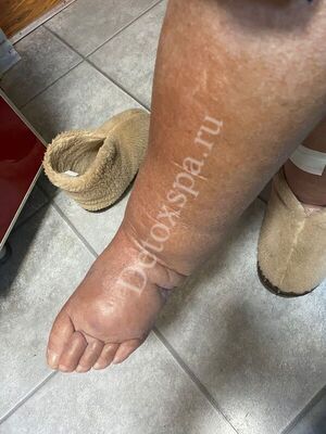 ��������� - �������� ����