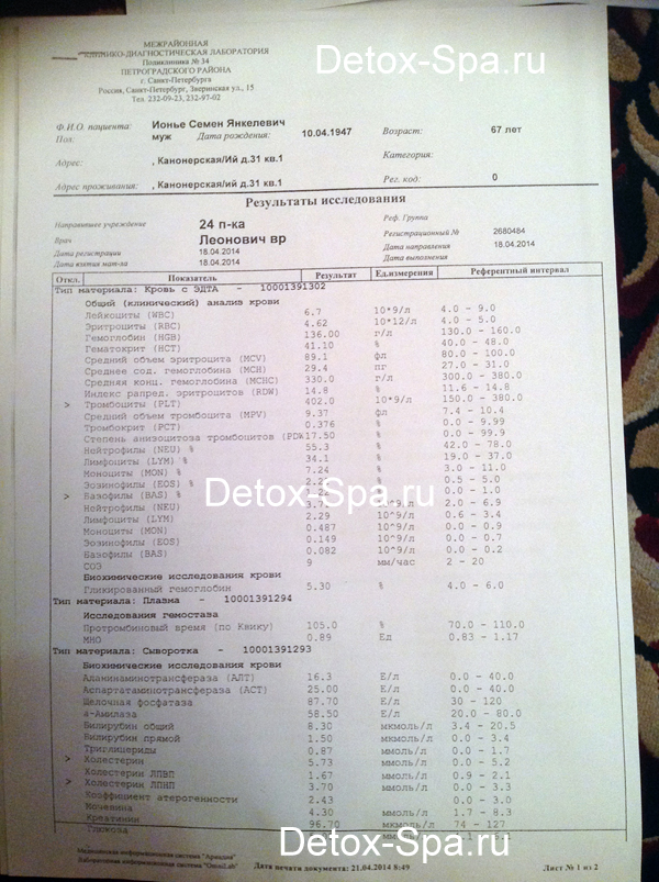 ������� ������� ����� ���, ������������ ���������,