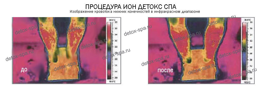 ��������� ��� ������ ��� ������������ ������