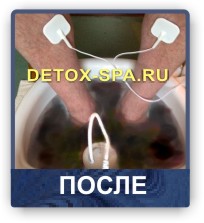������� Ion Detox Spa ��� ������ ������� ���������